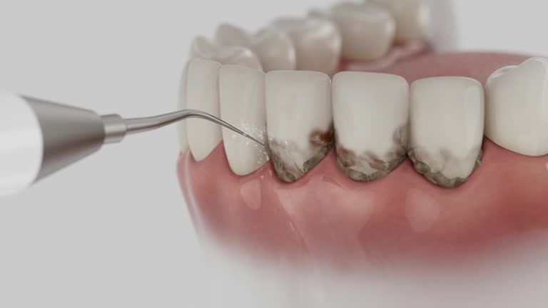Reliable Dental Implants contractor in Braxton County County, WV by Dentist Open Now